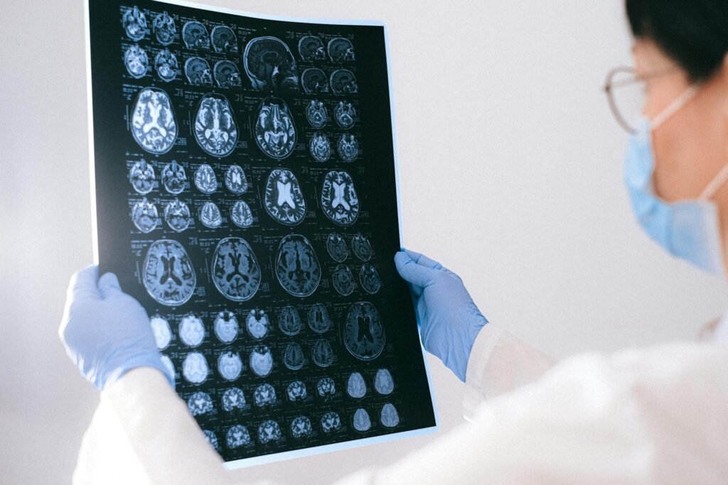 cerebro rehabilitacion del ictus